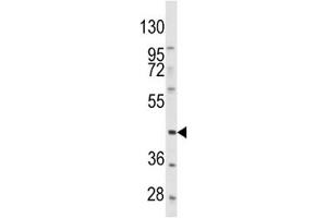 Western Blotting (WB) image for anti-Platelet-Derived Growth Factor Receptor-Like (PDGFRL) (AA 328-357) antibody (ABIN3032250)