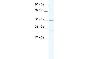 WB Suggested Anti-Mri1 Antibody Titration:  2. (MRI1 antibody  (C-Term))