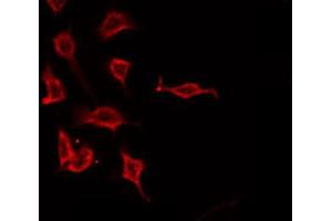 ABIN6266613 staining A549 by IF/ICC. (PTH antibody  (Internal Region))