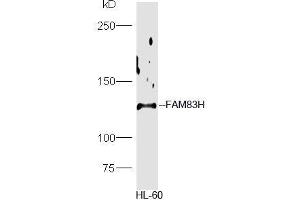 HL-60 lysate probed with Rabbit Anti-FAM83H Polyclonal Antibody, Unconjugated  at 1:5000 for 90min at 37˚C. (FAM83H antibody  (AA 1001-1179))