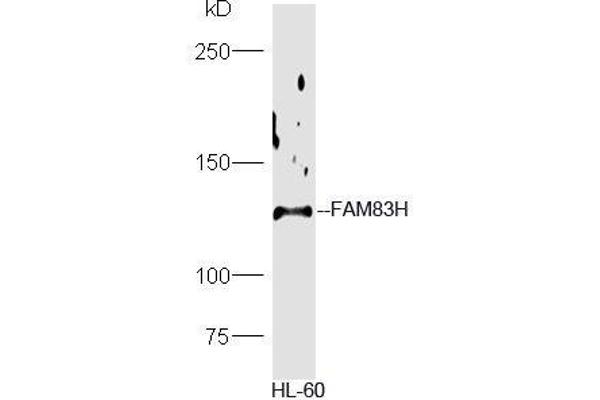 FAM83H anticorps  (AA 1001-1179)