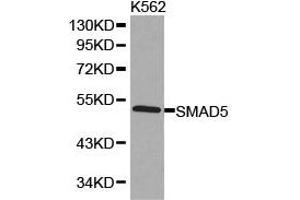 Western Blotting (WB) image for anti-SMAD, Mothers Against DPP Homolog 5 (SMAD5) antibody (ABIN1874857) (SMAD5 antibody)