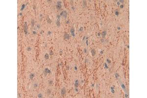Used in DAB staining on fromalin fixed paraffin- embedded Kidney tissue (BCR antibody  (AA 1042-1243))