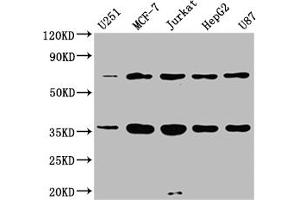 Western Blotting (WB) image for anti-Leucine-rich repeat protein SHOC-2 (SHOC2) (AA 3-89) antibody (ABIN7158098)