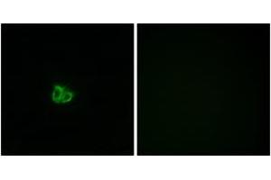 Immunofluorescence analysis of COS7 cells, using Stathmin 1 (Phospho-Ser15) Antibody. (Stathmin 1 antibody  (pSer16))