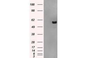 HEK293T cells were transfected with the pCMV6-ENTRY control (Left lane) or pCMV6-ENTRY ATP5B (Right lane) cDNA for 48 hrs and lysed. (ATP5B antibody)