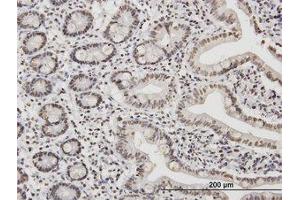 Image no. 1 for anti-TATA Box Binding Protein Associated Factor 11 (TAF11) (AA 158-211) antibody (ABIN598958) (TAF11 antibody  (AA 158-211))
