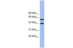 ALLC antibody used at 1 ug/ml to detect target protein. (Allantoicase antibody  (N-Term))