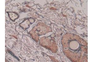 IHC-P analysis of Rat Skin Tissue, with DAB staining. (Pronociceptin (AA 12-181) antibody)