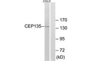 Western blot analysis of extracts from COLO cells, using CEP135 Antibody. (CEP135 antibody  (AA 1081-1130))