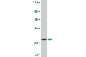 Western Blot detection against Immunogen (39. (GAL antibody  (AA 1-123))