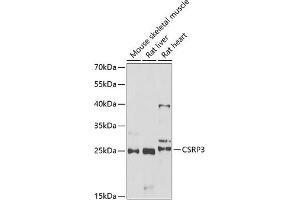 Western blot analysis of extracts of various cell lines, using CSRP3 antibody (ABIN6129258, ABIN6139141, ABIN6139143 and ABIN6222244) at 1:1000 dilution. (CSRP3 antibody  (AA 1-194))