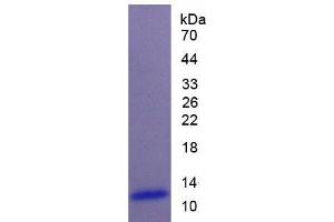 Image no. 1 for Natriuretic Peptide A (NPPA) (AA 25-152) protein (His tag) (ABIN4988364)
