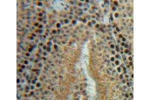 Used in DAB staining on fromalin fixed paraffin-embedded testis tissue (HSPH1 antibody  (AA 595-733))