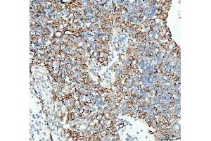 anti-Tumor Necrosis Factor Receptor Superfamily, Member 13B (TNFRSF13B) (AA 1-165) antibody