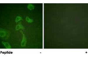 Immunofluorescence analysis of HeLa cells, using IL2RB polyclonal antibody .