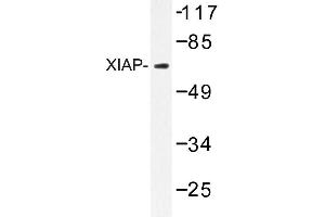 Image no. 1 for anti-X-Linked Inhibitor of Apoptosis (XIAP) antibody (ABIN272094)