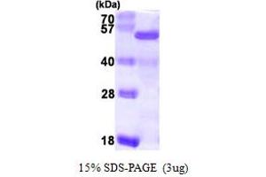 SDS-PAGE (SDS) image for RD RNA Binding Protein (RDBP) (AA 1-380) protein (His tag) (ABIN667394) (RDBP Protein (AA 1-380) (His tag))