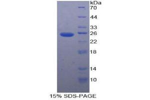 SDS-PAGE (SDS) image for Pyruvate Kinase, Liver and RBC (PKLR) (AA 219-420) protein (His tag) (ABIN1878904)