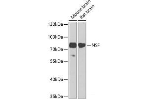 Western blot analysis of extracts of various cell lines using NSF Polyclonal Antibody at dilution of 1:1000. (NSF antibody)