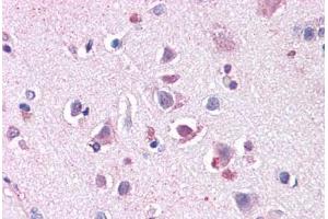 Anti-ENT1 antibody  ABIN1048563 IHC staining of human brain, cortex. (SLC29A1 antibody  (Internal Region))
