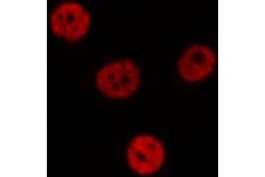 ABIN6275418 staining  NIH-3T3 cells by IF/ICC. (S100A16 antibody  (Internal Region))