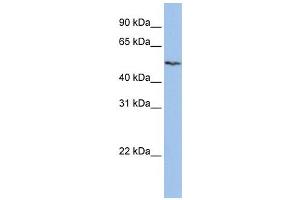 Western Blotting (WB) image for anti-Solute Carrier Family 16 (Monocarboxylic Acid Transporters), Member 6 (SLC16A6) antibody (ABIN2458786) (SLC16A6 antibody)