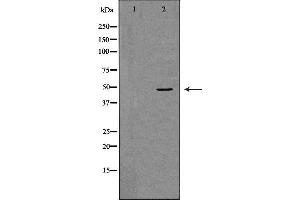 Western blot analysis of K562 whole cell lysates, using TNFRSF11B  Antibody. (Osteoprotegerin antibody  (Internal Region))