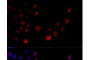 Immunofluorescence analysis of 293T cells using HNRNPH2 Polyclonal Antibody at dilution of 1:100 (40x lens). (HNRNPH2 antibody)