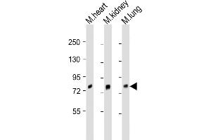 All lanes : Anti-Brd7 Antibody (Center) at 1:2000 dilution Lane 1: mouse heart lysate Lane 2: mouse kidney lysate Lane 3: mouse lung lysate Lysates/proteins at 20 μg per lane. (BRD7 antibody  (AA 387-418))