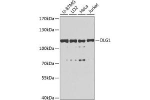 Western blot analysis of extracts of various cell lines, using DLG1 antibody (ABIN6130273, ABIN6139646, ABIN6139648 and ABIN6224636) at 1:1000 dilution. (DLG1 antibody  (AA 1-190))