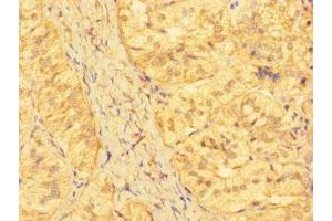 Immunohistochemistry of paraffin-embedded human adrenal gland tissue using ABIN7157336 at dilution of 1:100 (KRTAP23-1 antibody  (AA 1-65))