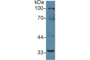 Western Blot; Sample: Mouse Liver lysate; Primary Ab: 2µg/ml Rabbit Anti-Mouse RANk Antibody Second Ab: 0. (TNFRSF11A antibody  (AA 359-542))