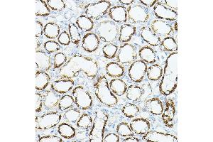 Immunohistochemistry of paraffin-embedded rat kidney using VEGFB Rabbit pAb (ABIN6128909, ABIN6150090, ABIN6150092 and ABIN6216417) at dilution of 1:150 (40x lens). (VEGFB antibody  (AA 25-207))