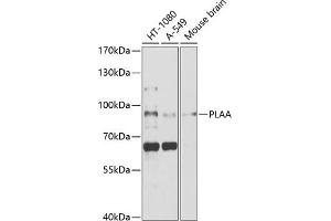 Western blot analysis of extracts of various cell lines, using PLAA antibody (ABIN1682194, ABIN3018787, ABIN3018788 and ABIN6220577) at 1:1000 dilution. (PLAA antibody  (AA 536-795))