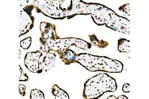 IHC analysis of CBX2 using anti-CBX2 antibody (ABIN7599466). (CBX2 antibody  (AA 1-532))