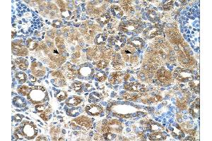 Immunohistochemistry (IHC) image for anti-UBX Domain Protein 4 (UBXN4) (Middle Region) antibody (ABIN2783052) (UBXD2 antibody  (Middle Region))