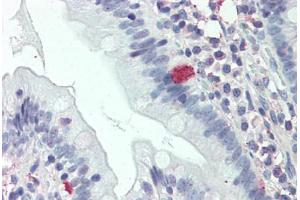 Anti-C8orf55 antibody  ABIN1048366 IHC staining of human small intestine. (THEM6 antibody  (Internal Region))