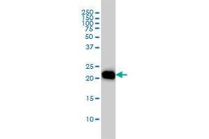 RHOA monoclonal antibody (M04), clone 1B12 Western Blot analysis of RHOA expression in HL-60 . (RHOA antibody  (AA 1-193))