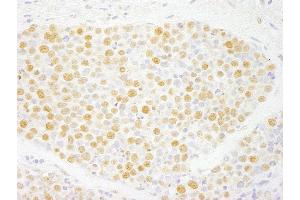 Immunohistochemistry (IHC) image for anti-Zinc Finger, MYM-Type 2 (ZMYM2) (AA 1327-1377) antibody (ABIN7448880)