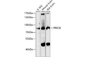 Western blot analysis of extracts of various cell lines, using PRKCB antibody (ABIN6128463, ABIN6146200, ABIN6146202 and ABIN6221544) at 1:3000 dilution. (PKC beta antibody  (AA 220-340))