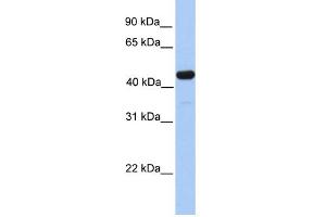 WB Suggested Anti-GAL3ST3 Antibody Titration:  0. (GAL3ST3 antibody  (C-Term))