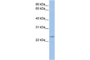 WB Suggested Anti-FKBP3  Antibody Titration: 0. (FKBP3 antibody  (C-Term))