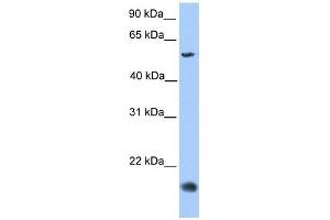 CMTM8 antibody used at 1 ug/ml to detect target protein. (CMTM8 antibody  (Middle Region))