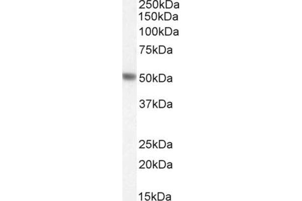Phenylalanine Hydroxylase antibody  (Internal Region)