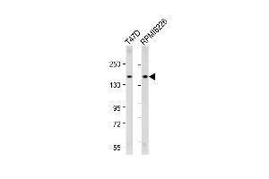 All lanes : Anti-ABCC12 Antibody (Center) at 1:2000 dilution Lane 1: T47D whole cell lysate Lane 2: R whole cell lysate Lysates/proteins at 20 μg per lane. (ABCC12 antibody  (AA 723-752))