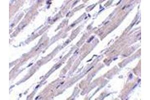 Immunohistochemistry of Bcl-rambo in human heart tissue with Bcl-rambo antibody at 10 μg/ml. (BCL2L13 antibody  (Intermediate Domain))