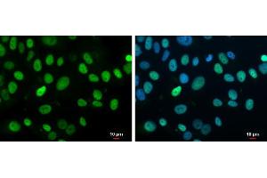 ICC/IF Image Rb antibody detects Rb protein at nucleus by immunofluorescent analysis. (Retinoblastoma 1 antibody  (C-Term))