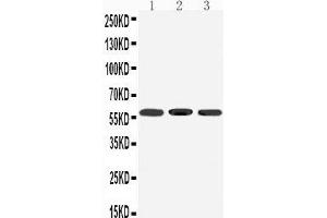Western Blotting (WB) image for anti-Dopamine Receptor D5 (DRD5) (AA 388-407), (C-Term) antibody (ABIN3042836) (DRD5 antibody  (C-Term))