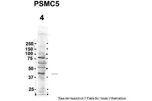 PSMC5 antibody  (C-Term)